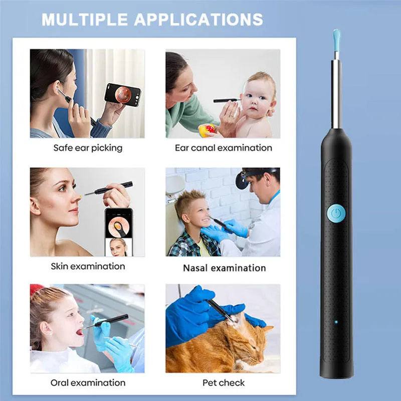 Smart Wireless Ear Camera – HD Ear Wax Cleaner with 6 LED Lights & Silicone Tips