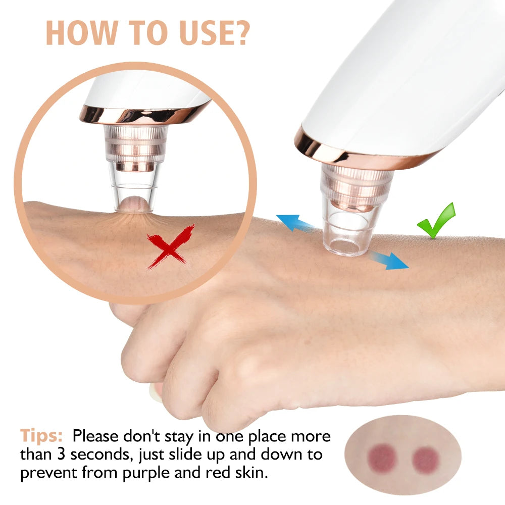 USB Rechargeable Blackhead Remover